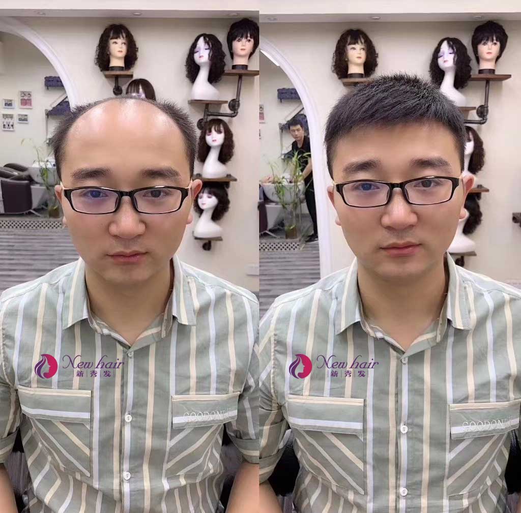 很多網(wǎng)友問我，為什么現(xiàn)在那么多人喜歡帶真發(fā)做的假發(fā)？