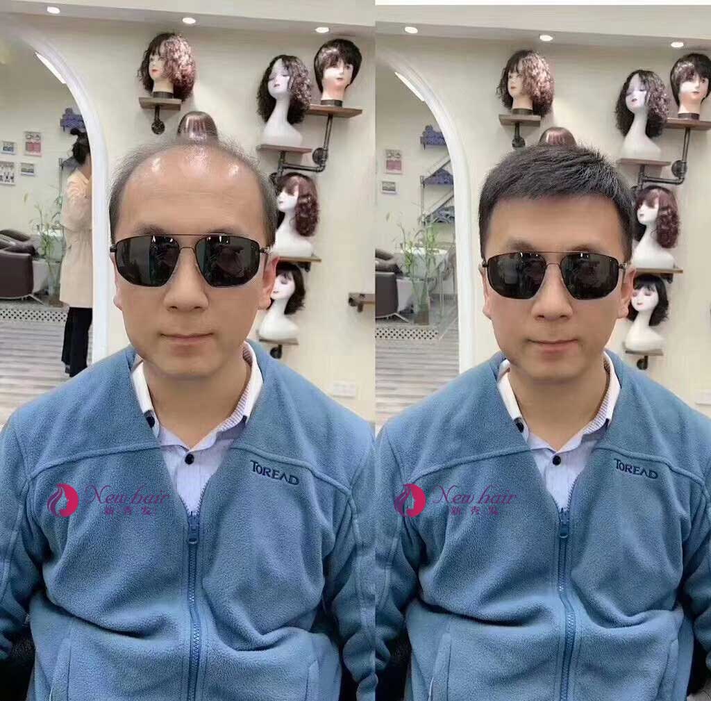 老年男士假發(fā)佩戴效果怎么樣？有沒有副作用？