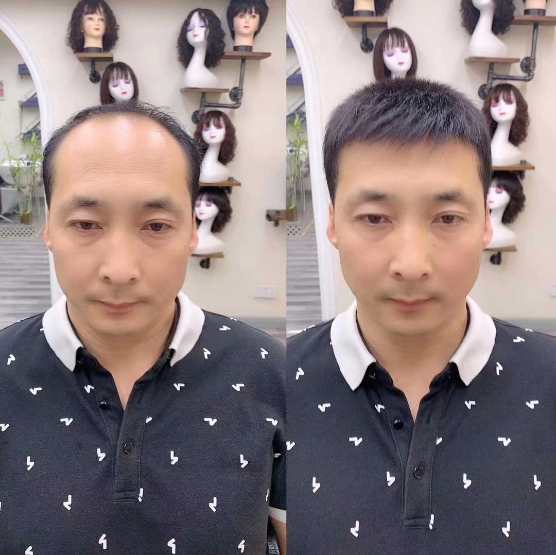 在青島這是脫發(fā)朋友真正需要的假發(fā)片！