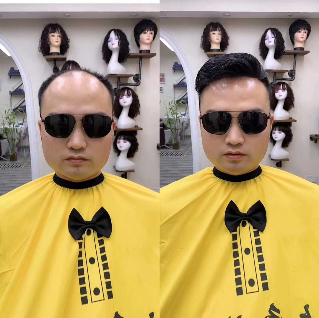 拯救禿頭造型，新秀發(fā)假發(fā)片立刻還你年輕自信人生！