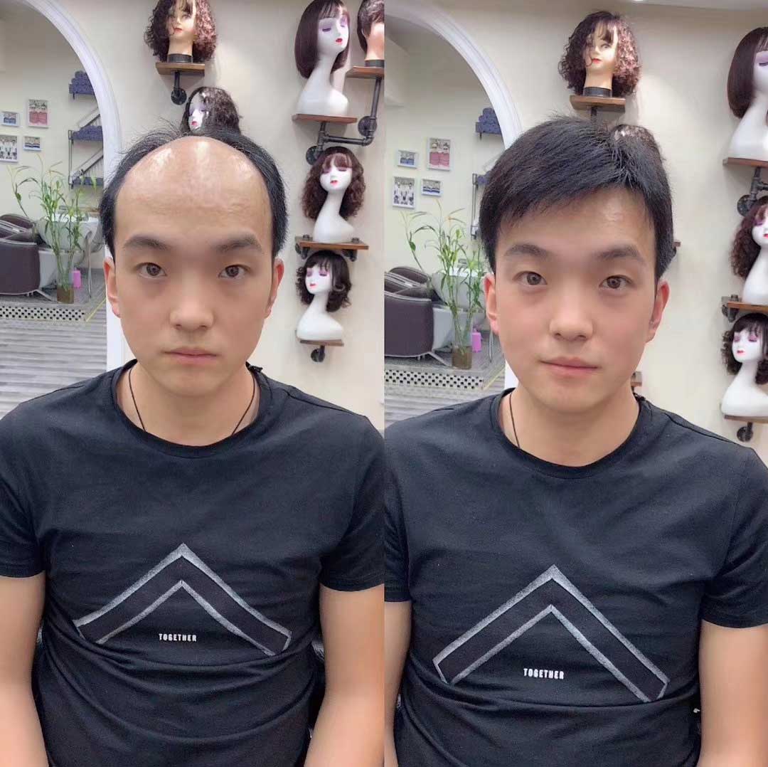 男人就該注重自己的形象，大叔通過假發(fā)片恢復發(fā)量變小鮮肉。