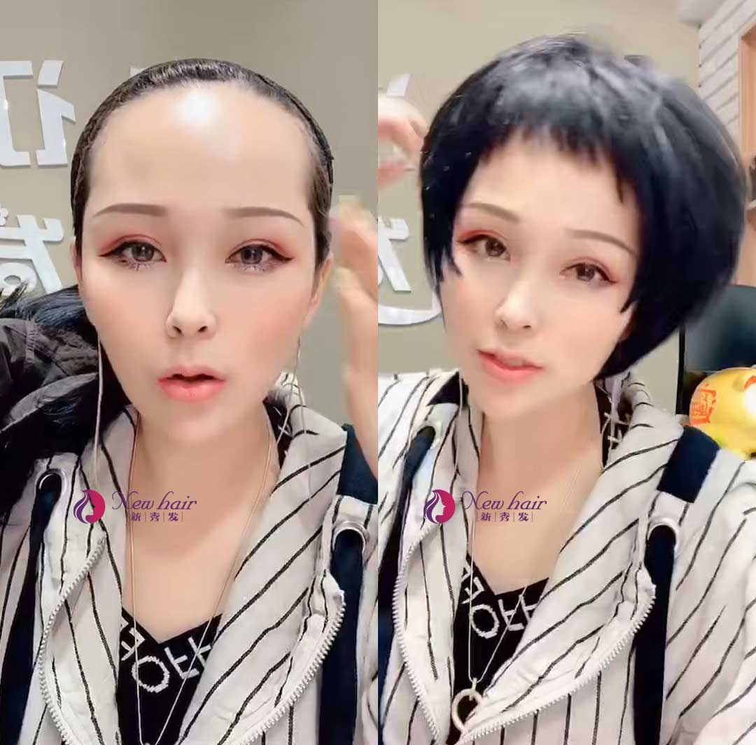 怎么佩戴假發(fā)？假發(fā)套價格怎么計算？