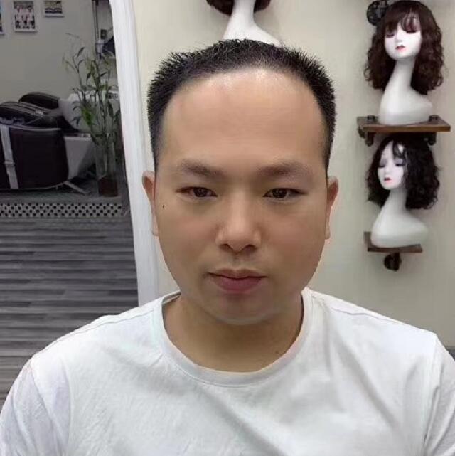 怎么樣才有勇氣佩戴假發(fā)？
